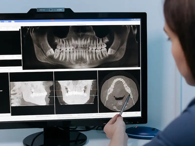 Equipo de radiografía digital para diagnóstico preciso